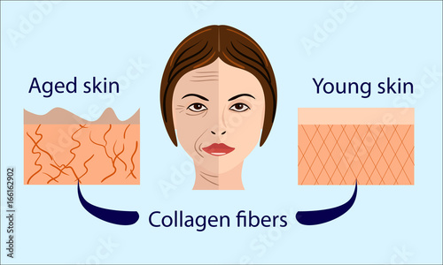 skin aging diagrams. young skin is firm tight, its collagen Vector illustration with a face and two types of skin - aged and young