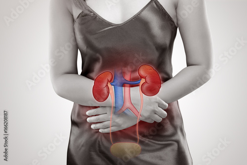 Kidney disease and  Kidney failure photo