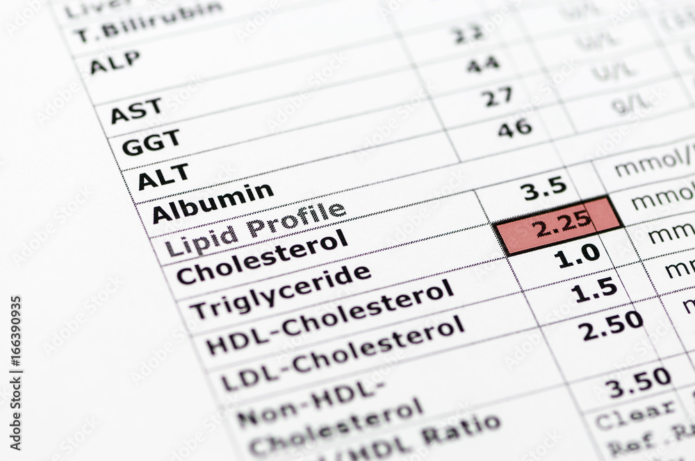 Blood chemistry report showing normal liver function tests, and a lipid profile with high triglyceride levels. Blood chemistry report showing normal liver function tests, and a lipid profile with high triglyceride levels.