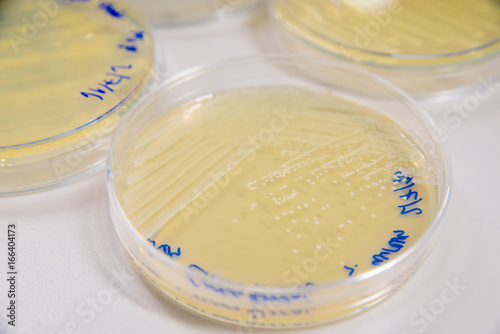 Close-up detail of multiple plates of petri dishes containing cultures of Methicillin-Resistant Staphylococcus Aureus (MRSA). Healthcare and infectious diseases concept. photo