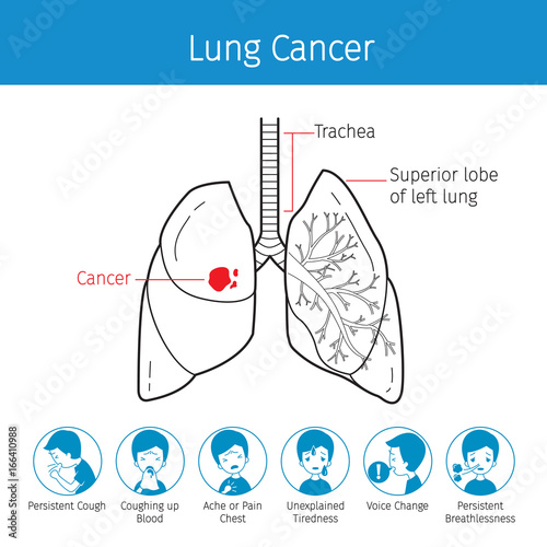 Illustration Of Human Lungs, Outline And Lung Cancer Symptoms Icons, Physiology, Sickness, Medical Profession, Morphology, Body, Organs, Health 