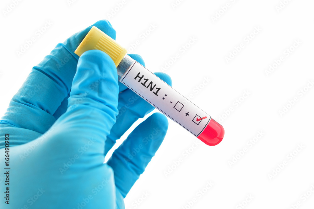 Fototapeta premium Blood sample positive with H1N1 influenza virus 