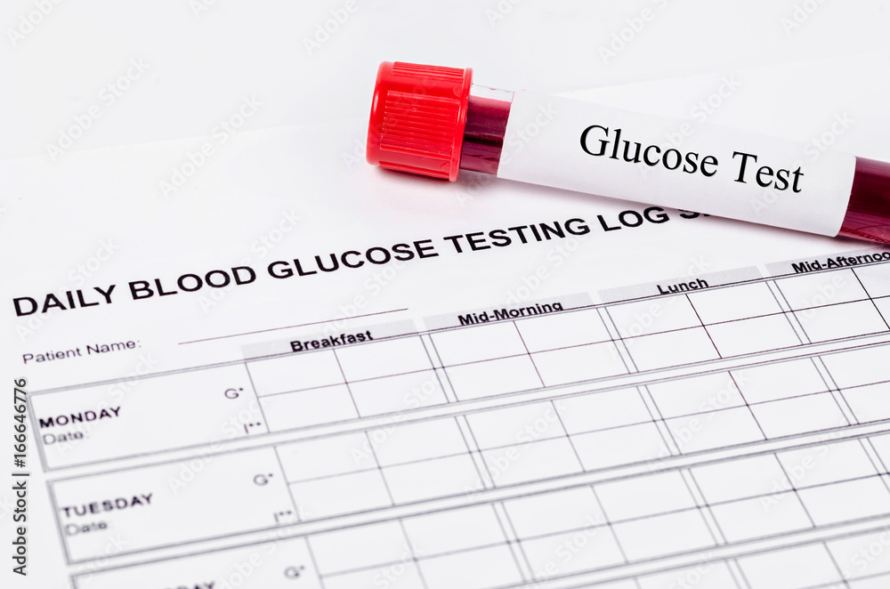 Obraz premium Daily blood glucose testing.