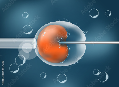In vitro fertilisation. IVF. Illustration easy editable for Your color of background.