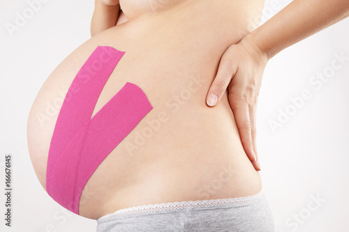 Therapeutic taping in pregnancy. photo