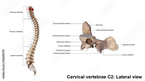Cervical vertebrae C2_Lateral view photo