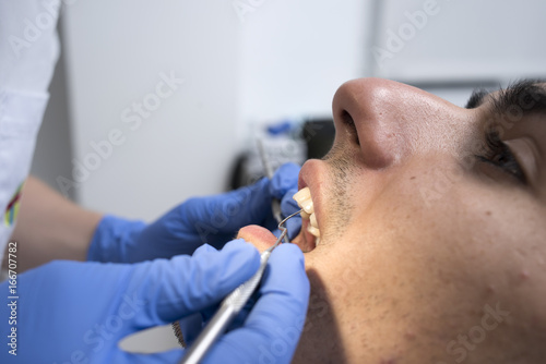 Dentist working with patient. close up.