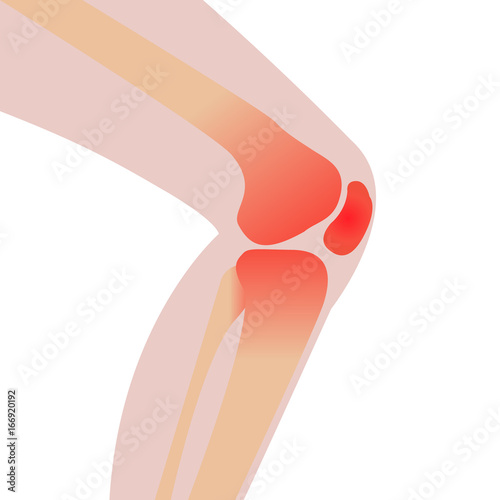 Knee injury