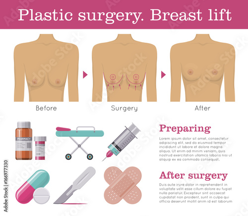 Breast lift plastic surgery. Mastopexy procedure clinic poster. Health promotion and education for women concept. Mockup vector illustration on white background