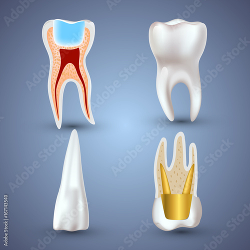Vector set of 3d realistic clean and dirty tooth isolated on gray background. Dental health Concept. Oral Care, teeth restoration