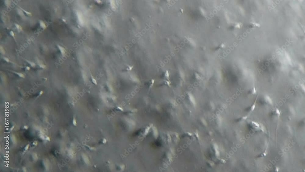 Sperm Sample Fertility Test 600x Phase Contrast Microscope Stock Video