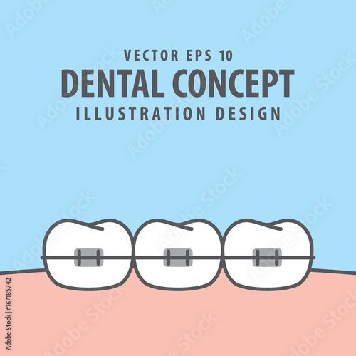  Orthodontic teeth illustration vector on blue background. Dental concept.