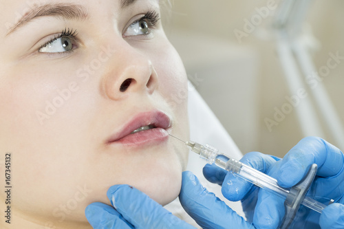 The process of cosmetic surgery of injection in the area of the lips of a woman