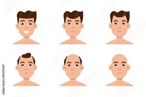 Hair stages loss. Types of baldness on male head vector.