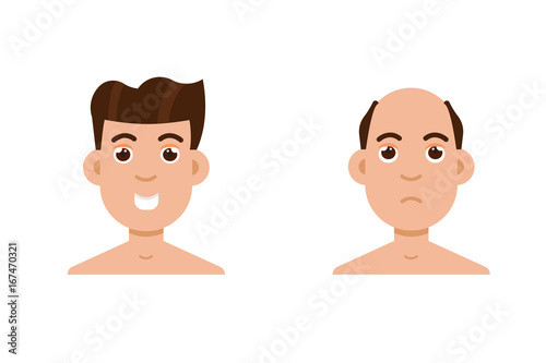 Hair stages loss. Types of baldness on male head vector.