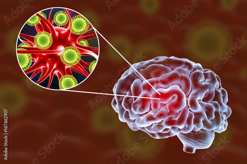 Viral encephalitis, 3D illustration showing brain and close-up view of viruses and neurons photo