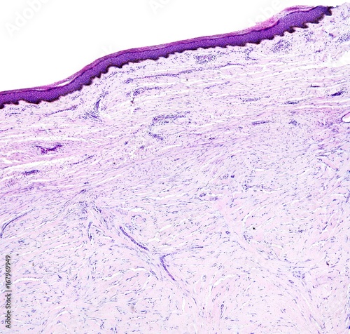 Histology of human tissue, show skin as seen under the microscope