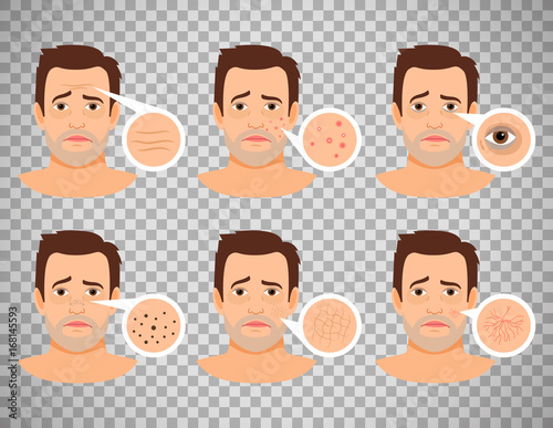 Man skin problems