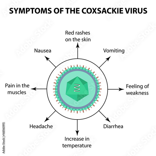 Symptoms of infection Coxsackie virus. Enterovirus. Infographics. Vector illustration on isolated background photo