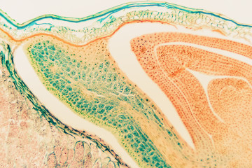 Papier peint photo Photographie macro Charançon du seigle en microscopie  © Digital Photo