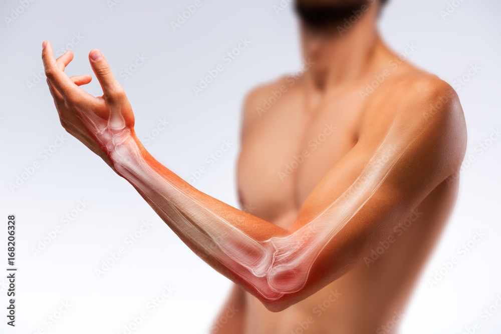 Anatomy of human arm. Bone pain. Stock Photo Adobe Stock
