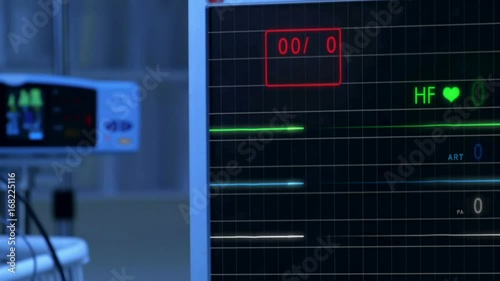 Cinemagraph of pulse checking E.C.G Monitor without pulse