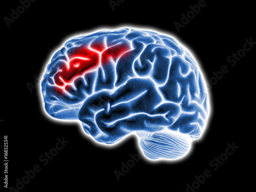 brain pain illustration