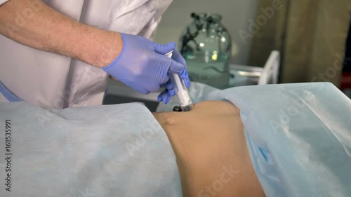 A doctor slowly placing a leech on patients skin. photo