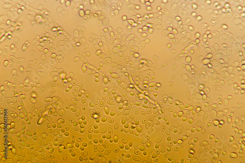 Yeast under the microscope.