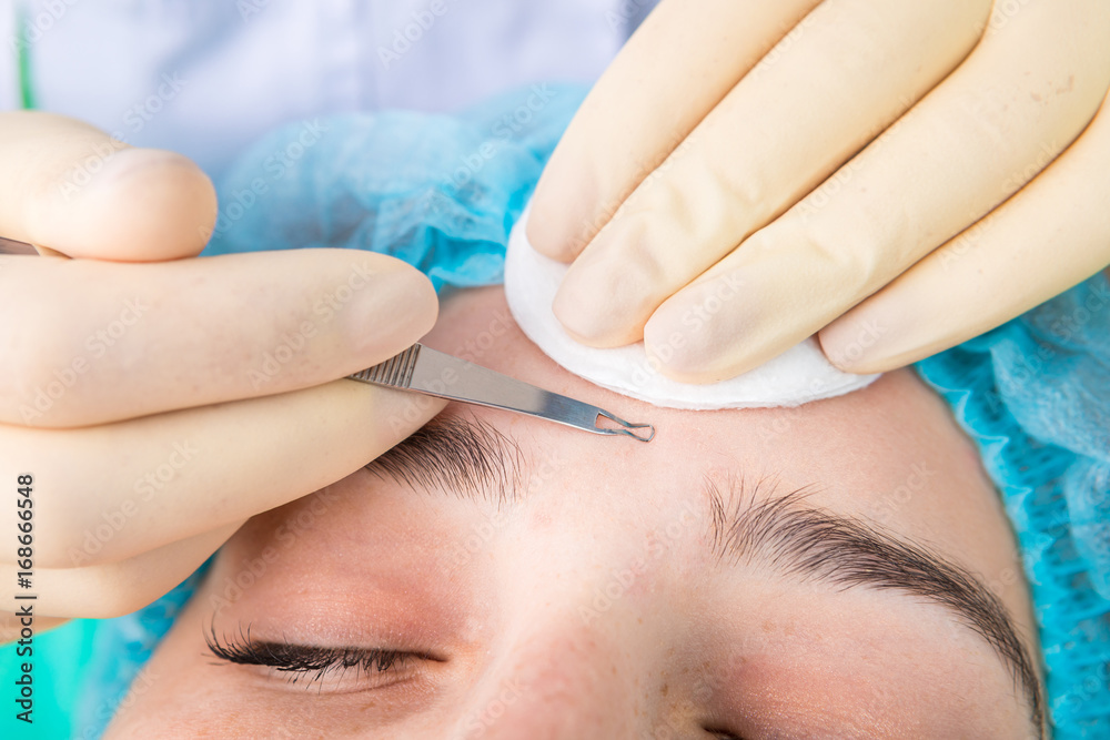 Fototapeta premium Skin cleaning of young teenager girl . Professional cosmetologist services clinic