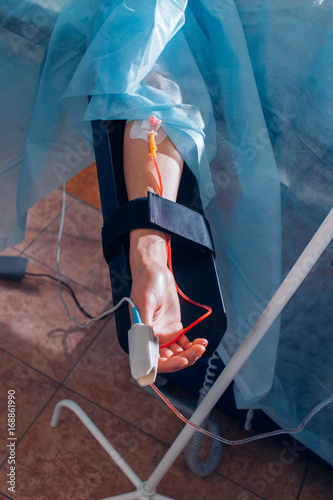 patient lies on the operating surgical table during rhinoplastic operation surgery with anesthesia photo