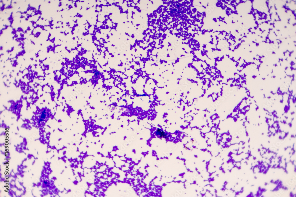 Bacillus is a genus of gram-positive, rod-shaped bacteria and a member of the phylum Firmicutes. Bacillus is a genus of gram-positive, rod-shaped bacteria and a member of the phylum Firmicutes.