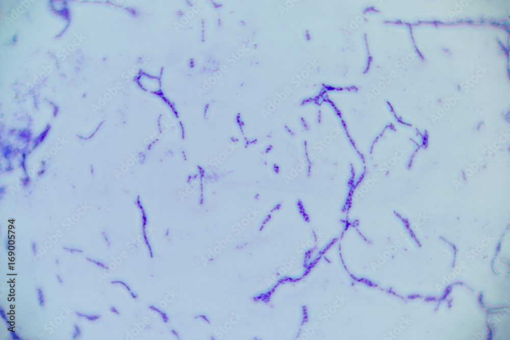 Bacillus is a genus of grampositive, rodshaped bacteria and a member