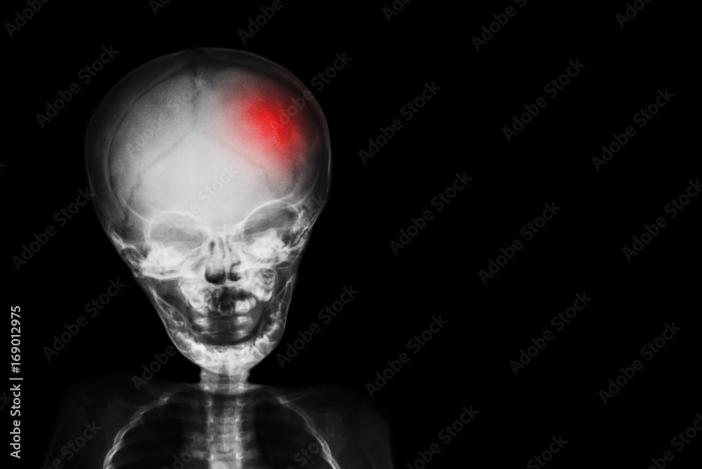Canvastavla Stroke