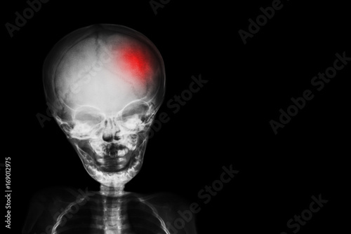 Canvastavla Stroke