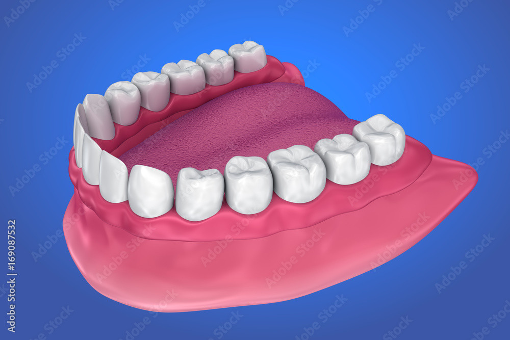 Fototapeta premium All missing teeth - removable full denture. 3D illustration