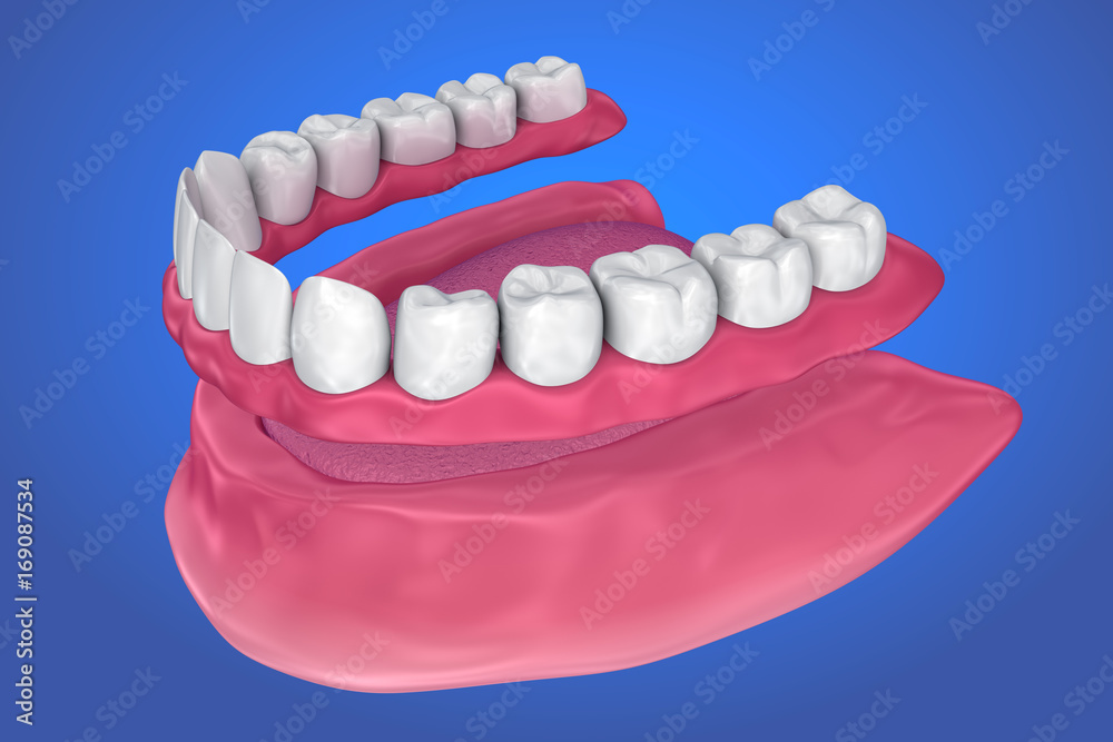 Fototapeta premium All missing teeth - removable full denture. 3D illustration