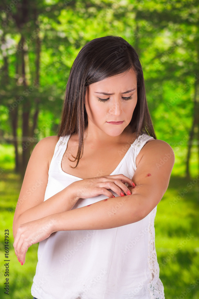 Close up of young woman suffering from itch after mosquito bites, in a blurred background Close up of young woman suffering from itch after mosquito bites, in a blurred background
