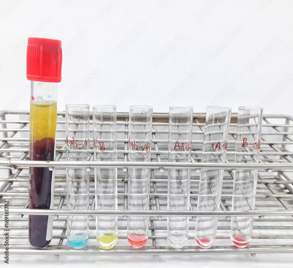 ABO Blood Grouping By Tube Method Forward Grouping And Reverse Grouping Stock Photo Adobe Stock