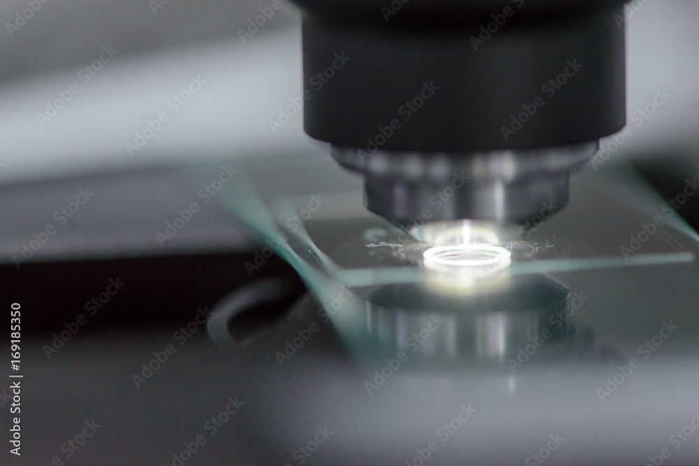 Close-up detail of a glass slide containing cancer samples with cover under the objective lens of a microscope, with bright glowing light. Science and medicine concept. Close-up detail of a glass slide containing cancer samples with cover under the objective lens of a microscope, with bright glowing light. Science and medicine concept.