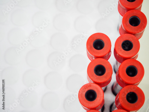 Close-up detail of multiple vacutainer tubes with red tops in a foam rack at a hospital. Healthcare and medical equipment concept.