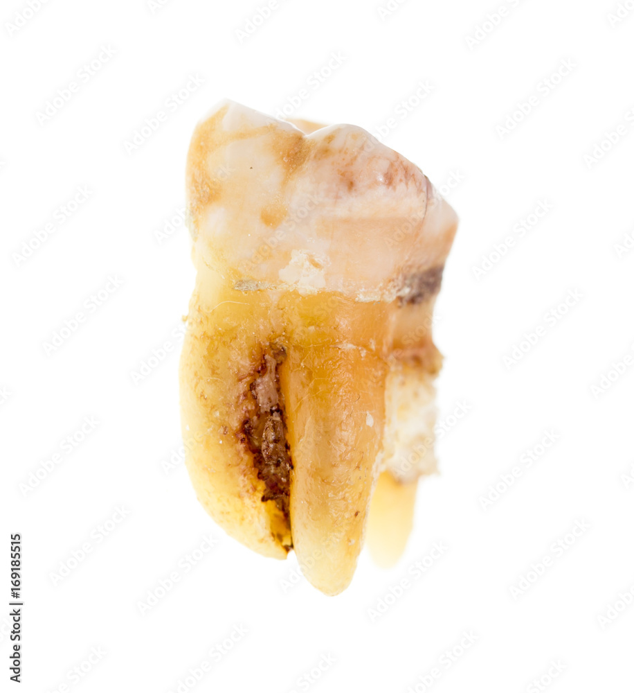 Old torn tooth on a white background
