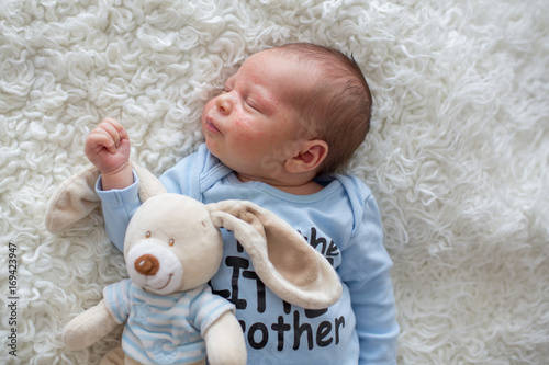 Little newborn baby sleeping, baby with scin rash