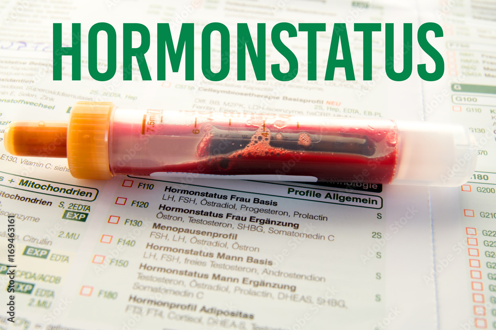 Hormonstatus / Blutprobe auf Laborzettel StockFoto Adobe Stock