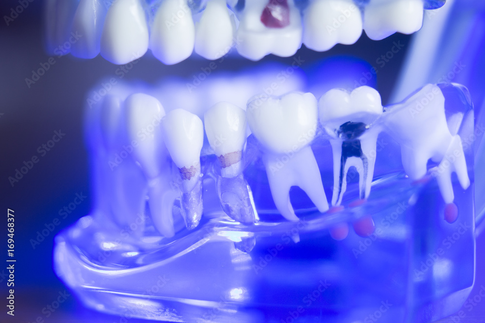 Dental teeth root nerve Dental teeth root nerve