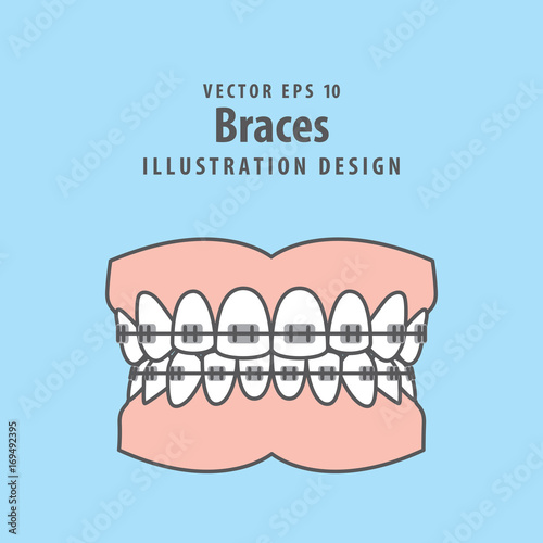 Braces teeth(full) illustration vector on blue background. Dental concept.