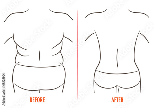 Thick and thin, overweight problem concept. Female torso with fat and lean shoulders, back and hips. Back before and after diet, fitness or liposuction. Vector illustration of woman rear, isolated