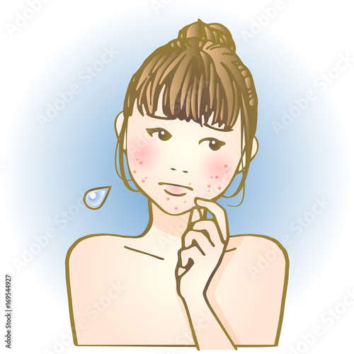 トラブル肌女子