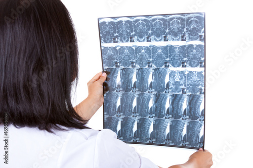 Medical Woman Doctor Examining X-Ray Picture