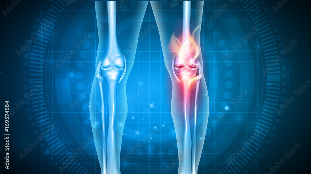 Joint problems bright abstract design, burning damaged knee Joint problems bright abstract design, burning damaged knee